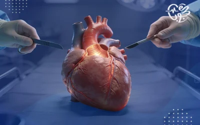 عملية استبدال الصمام الميترالي