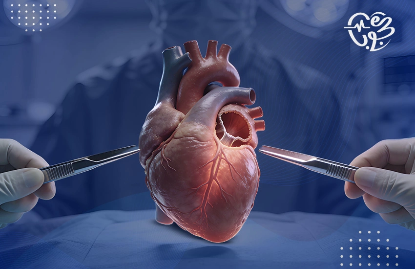 عملية تغيير الصمام الأورطي