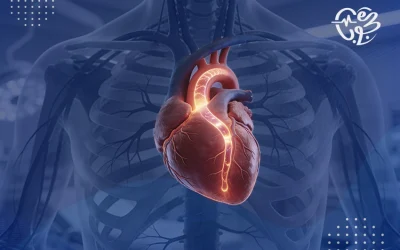 علاج انسداد الشريان التاجي