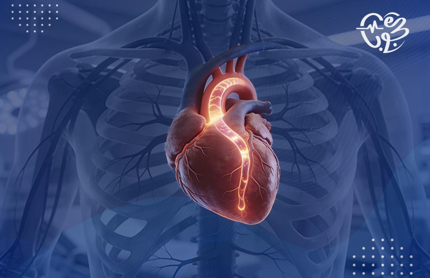 علاج-انسداد-الشريان-التاجي32 علاج انسداد الشريان التاجي