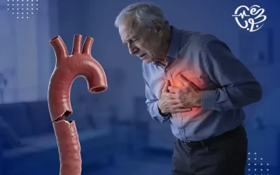أعراض تمزق الشريان الأورطي.. ناقوس خطر يهدد الحياة
