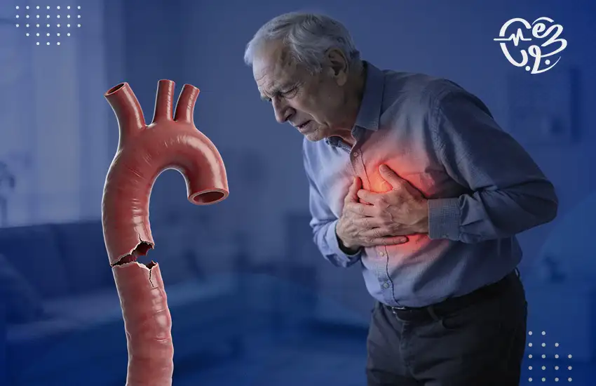 اعراض-تمزق-الشريان-الاورطي أعراض تمزق الشريان الأورطي