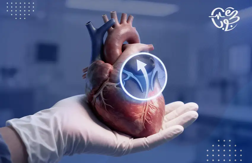 علاج ارتجاع الصمام الميترالي