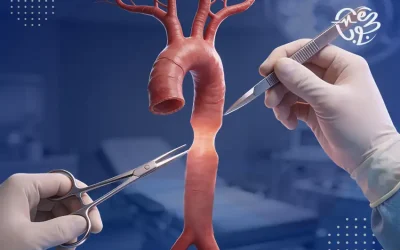 ما وسائل علاج ضيق الشريان الأورطي؟