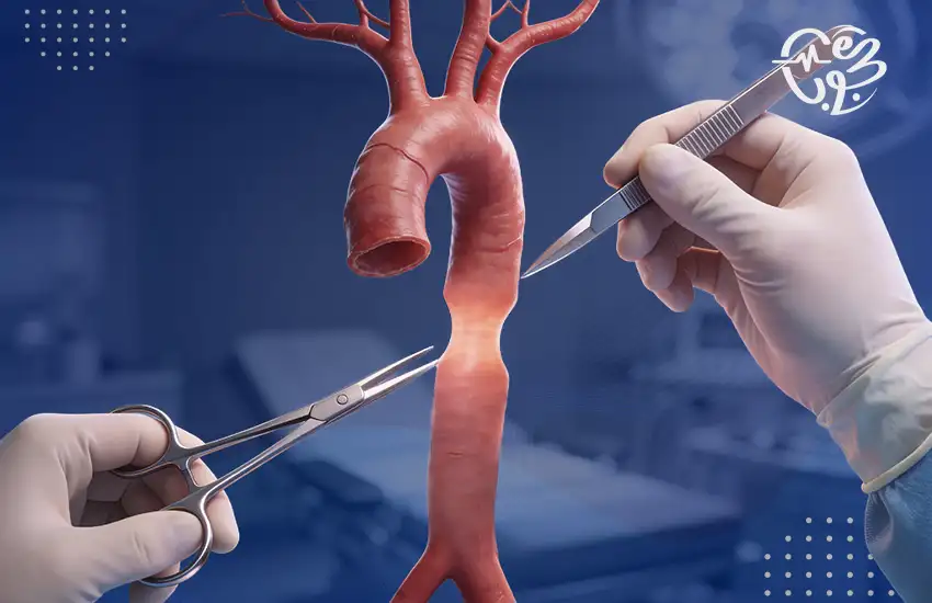 علاج ضيق الشريان الأورطي