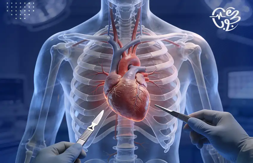 عملية-القلب-المفتوح عملية القلب المفتوح