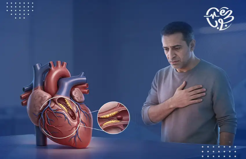 أعراض ضيق الشريان التاجي