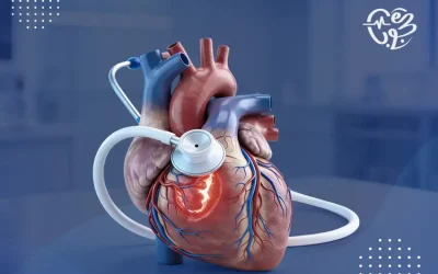علاج ضيق الشريان التاجى